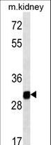GNPDA1 Antibody - GNPDA1 western blot of mouse kidney tissue lysates (35 ug/lane). The GNPDA1 antibody detected the GNPDA1 protein (arrow).