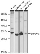 GNPDA1 Antibody - Western blot analysis of extracts of various cell lines, using GNPDA1 antibody at 1:3000 dilution. The secondary antibody used was an HRP Goat Anti-Rabbit IgG (H+L) at 1:10000 dilution. Lysates were loaded 25ug per lane and 3% nonfat dry milk in TBST was used for blocking. An ECL Kit was used for detection and the exposure time was 30s.
