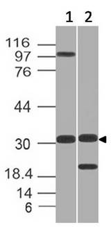 GNPDA1 Antibody - Fig-1: Expression analysis of GNPDA1. Anti-GNPDA1 antibody was used at 1 µg/ml on (1) h Testis and (2) h Kidney lysates