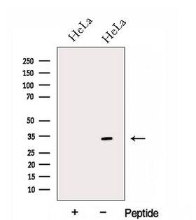 GNPDA1 Antibody - Western blot analysis of extracts of HeLa cells using GNPDA1 antibody. The lane on the left was treated with blocking peptide.
