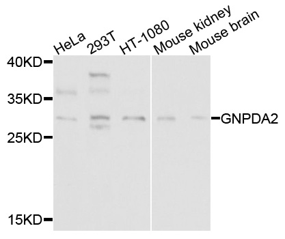 GNPDA2 Antibody - Western blot analysis of extracts of various cells.