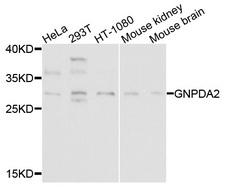 GNPDA2 Antibody - Western blot analysis of extracts of various cells.