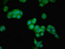 GNPDA2 Antibody - Immunofluorescent analysis of PC-3 cells using GNPDA2 Antibody at dilution of 1:100 and Alexa Fluor 488-congugated AffiniPure Goat Anti-Rabbit IgG(H+L)
