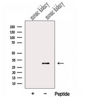 GNPDA2 Antibody - Western blot analysis of extracts of mouse kidney tissue using GNPDA2 antibody. The lane on the left was treated with blocking peptide.