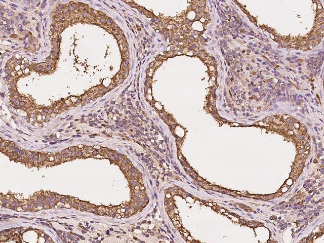 GNPDA2 Antibody - Immunochemical staining of human GNPDA2 in human testis with rabbit polyclonal antibody at 1:5000 dilution, formalin-fixed paraffin embedded sections.