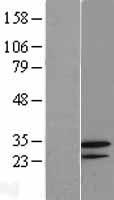 GNPDA2 Protein - Western validation with an anti-DDK antibody * L: Control HEK293 lysate R: Over-expression lysate