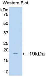 GNRH Antibody - Western blot of recombinant GNRH. This image was taken for the unconjugated form of this product. Other forms have not been tested.