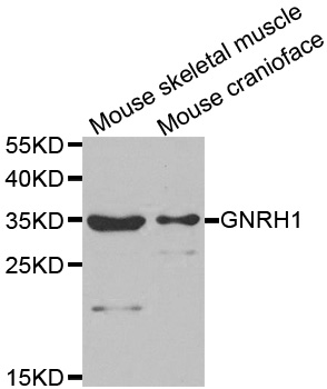 GNRH Antibody - Western blot analysis of extracts of various tissues.