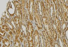 GNRH Antibody - 1:100 staining mouse kidney tissue by IHC-P. The sample was formaldehyde fixed and a heat mediated antigen retrieval step in citrate buffer was performed. The sample was then blocked and incubated with the antibody for 1.5 hours at 22°C. An HRP conjugated goat anti-rabbit antibody was used as the secondary.