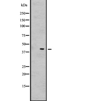 GnRH-II-R / GNRHR2 Antibody - Western blot analysis of GNRHR2 expression in HeLa cells lysate. The lane on the left is treated with the antigen-specific peptide.