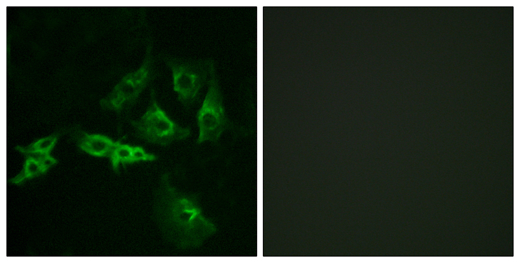 GnRH receptor / GNRHR Antibody - Immunofluorescence analysis of A549 cells, using GNRHR Antibody. The picture on the right is blocked with the synthesized peptide.