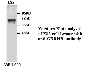 GnRH receptor / GNRHR Antibody