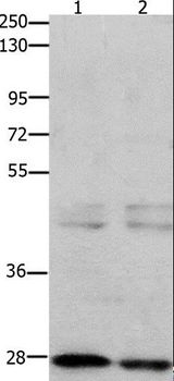GnRH receptor / GNRHR Antibody - Western blot analysis of 231 cell and mouse testis tissue, using GNRHR Polyclonal Antibody at dilution of 1:650.