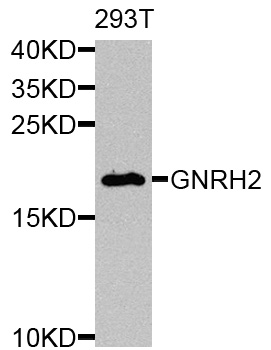 GNRH2 Antibody - Western blot analysis of extracts of 293T cells.