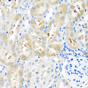 GNRH2 Antibody - Immunohistochemistry of paraffin-embedded rat kidney tissue.