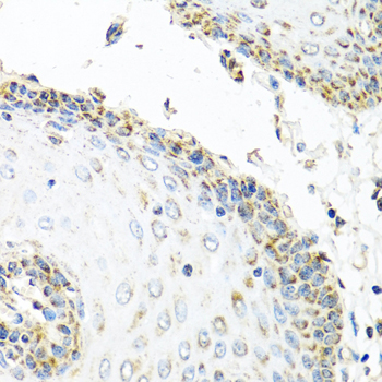 GNRH2 Antibody - Immunohistochemistry of paraffin-embedded human esophagus.