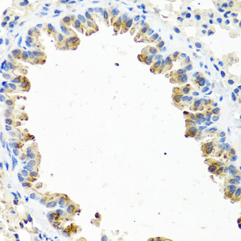 GNRH2 Antibody - Immunohistochemistry of paraffin-embedded mouse lung tissue.