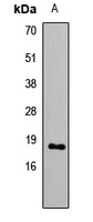 GNRH2 Antibody - Western blot: HEK293T whole cell lysates