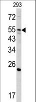 GNS Antibody - Western blot of GNS antibody (Center N189) in 293 cell line lysates (35 ug/lane). GNS (arrow) was detected using the purified antibody.
