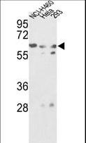 GNS Antibody - Western blot of GNS Antibody (Center S298) in NCI-H460, HeLa, 293 cell line lysates (35 ug/lane). GNS (arrow) was detected using the purified antibody.