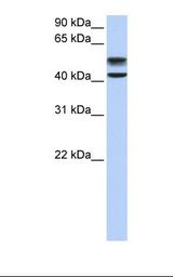 GNS Antibody - Fetal liver lysate. Antibody concentration: 1.0 ug/ml. Gel concentration: 12%.  This image was taken for the unconjugated form of this product. Other forms have not been tested.