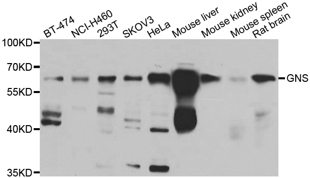 GNS Antibody - Western blot analysis of extracts of various cell lines.