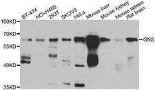 GNS Antibody - Western blot analysis of extracts of various cell lines.