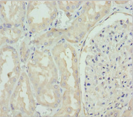 GNS Antibody - Immunohistochemistry of paraffin-embedded human kidney tissue at dilution 1:100