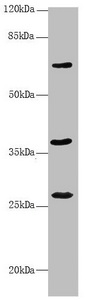 GNS Antibody - Western blot All Lanes:GNS antibody at 3.61 ug/ml +Mouse liver tissue Secondary Goat polyclonal to rabbit IgG at 1/10000 dilution Predicted band size: 63,60 kDa Observed band size: 62,27,37 kDa