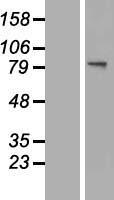 GNS Protein - Western validation with an anti-DDK antibody * L: Control HEK293 lysate R: Over-expression lysate