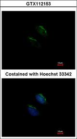 GNT-III / MGAT3 Antibody - Immunofluorescence of methanol-fixed HeLa using GnT-III antibody at 1:200 dilution.