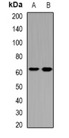 GNT-III / MGAT3 Antibody - Western blot analysis of GnT-III expression in SW620 (A); SKOV3 (B) whole cell lysates.