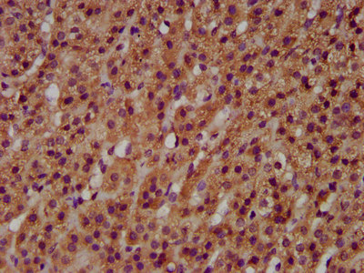 GNT-III / MGAT3 Antibody - Immunohistochemistry image at a dilution of 1:600 and staining in paraffin-embedded human adrenal gland tissue performed on a Leica BondTM system. After dewaxing and hydration, antigen retrieval was mediated by high pressure in a citrate buffer (pH 6.0) . Section was blocked with 10% normal goat serum 30min at RT. Then primary antibody (1% BSA) was incubated at 4 °C overnight. The primary is detected by a biotinylated secondary antibody and visualized using an HRP conjugated SP system.