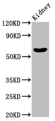 GNT-III / MGAT3 Antibody - Positive Western Blot detected in Mouse kidney tissue. All lanes: MGAT3 antibody at 2.35 µg/ml Secondary Goat polyclonal to rabbit IgG at 1/50000 dilution. Predicted band size: 62 KDa. Observed band size: 62 KDa