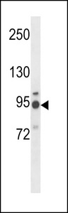 GNT-V / MGAT5 Antibody - MGAT5 Antibody western blot of NCI-H460 cell line lysates (35 ug/lane). The MGAT5 antibody detected the MGAT5 protein (arrow).