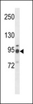GNT-V / MGAT5 Antibody - MGAT5 Antibody western blot of NCI-H460 cell line lysates (35 ug/lane). The MGAT5 antibody detected the MGAT5 protein (arrow).