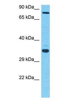 GNT-V / MGAT5 Antibody - Western blot of MGAT5 Antibody with human OVCAR-3 Whole Cell lysate.  This image was taken for the unconjugated form of this product. Other forms have not been tested.