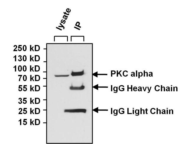 Mouse IgG Antibody - Mouse IgG (H+L) Antibody in Immunoprecipitation (IP)