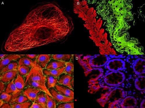 Mouse IgG2a Antibody - ATTO ® dyes can be used for multicolor immunofluorescent detection with low background and high signal. Examples shown are: A. Tubulin in PtK2- male Rat Kangaroo Kidney Epithelial Cells was detected using ATTO 532 labeled secondary antibody. B. Muscle alpha-actin was stained with a mouse primary antibody and ATTO 488 anti-mouse IgG (green) while Cytokeratin was stained with polyclonal rabbit anti-cytokeratin and ATTO 647N anti-rabbit IgG (red). C. HUVEC (Human umbilical vein endothelial cells were stained with anti- Vimentin-ATTO 532 (green), anti-E-Cadherin-ATTO 655 (red) and DAPI (blue). D. Rat colon sections were stained with Anti-Aquaporin 3-ATTO 594 antibody. Hoechst 33342 (blue) is used as counterstain. Images provided courtesy of Dr. Jörg Reichwein, ATTO-TEC GmbH