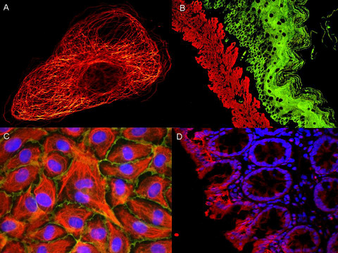 Rabbit IgG Antibody - ATTO dyes can be used for multicolor immunofluorescent detection with low background and high signal. Examples shown are: A. Tubulin in PtK2- male Rat Kangaroo Kidney Epithelial Cells was detected using ATTO 532 labeled secondary antibody. B. Muscle alpha-actin was stained with a mouse primary antibody and ATTO 488 anti-mouse IgG (green) while Cytokeratin was stained with polyclonal rabbit anti-cytokeratin and ATTO 647N anti-rabbit IgG (red). C. HUVEC (Human umbilical vein endothelial cells) stained with anti- Vimentin-ATTO 532 (green), anti-E-Cadherin-ATTO 655 (red) and DAPI (blue). D. Rat colon sections were stained with Anti-Aquaporin 3-ATTO 594 antibody. Hoechst 33342 (blue) is used as counterstain.
