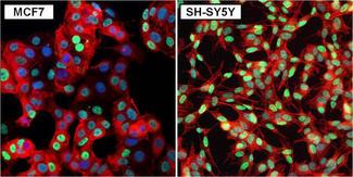 Rabbit IgG Antibody - Rabbit IgG (H+L) Antibody in Immunofluorescence (IF)