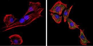 Rabbit IgG Antibody - Rabbit IgG (H+L) Antibody in Immunofluorescence (IF)