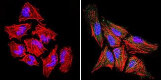 Rabbit IgG Antibody - Rabbit IgG (H+L) Antibody in Immunofluorescence (IF)