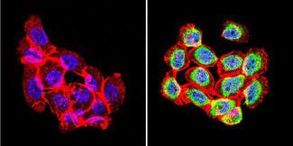 Rabbit IgG Antibody - Rabbit IgG (H+L) Antibody in Immunofluorescence (IF)