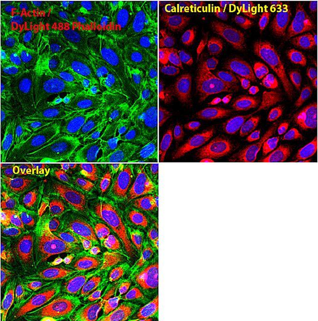 Rabbit IgG Antibody - Rabbit IgG (H+L) Antibody in Immunofluorescence (IF)