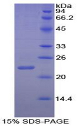 IL1A / IL-1 Alpha Protein - Recombinant Interleukin 1 Alpha By SDS-PAGE