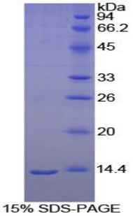 MTNR1A / Melatonin Receptor 1a Protein - Recombinant Melatonin Receptor 1A By SDS-PAGE