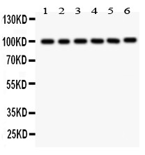 GOK / STIM1 Antibody - STIM1 antibody Western blot. All lanes: Anti STIM1 at 0.5 ug/ml. Lane 1: Rat Liver Tissue Lysate at 50 ug. Lane 2: Mouse Liver Tissue Lysate at 50 ug. Lane 3: Human Placenta Tissue Lysate at 50 ug. Lane 4: HELA Whole Cell Lysate at 40 ug. Lane 5: SMMC Whole Cell Lysate at 40 ug. Lane 6: HEPG2 Whole Cell Lysate at 40 ug. Predicted band size: 77 kD. Observed band size: 100 kD.