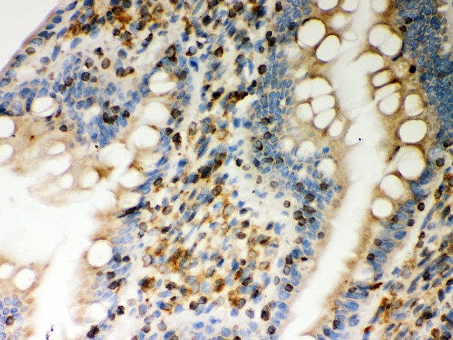 GOK / STIM1 Antibody - STIM1 antibody IHC-paraffin: Rat Intestine Tissue.