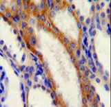GOK / STIM1 Antibody - STIM1 Antibody immunohistochemistry of formalin-fixed and paraffin-embedded human kidney tissue followed by peroxidase-conjugated secondary antibody and DAB staining.